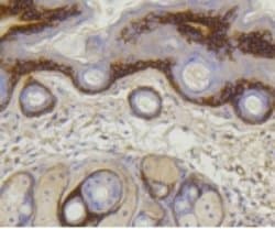 Invitrogen COL17A1 Recombinant Rabbit Monoclonal Antibody (2C3) 100 &mu;L;