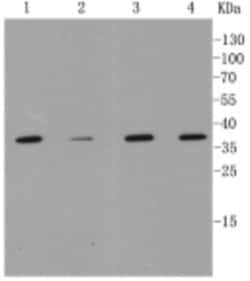 Invitrogen MMP12 Recombinant Rabbit Monoclonal Antibody (1C11) 100 &mu;L;