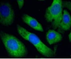 Invitrogen PHD1 Recombinant Rabbit Monoclonal Antibody (3G4) 100 &mu;L;