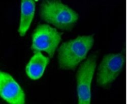 Invitrogen PHD1 Recombinant Rabbit Monoclonal Antibody (3G4) 100 &mu;L;