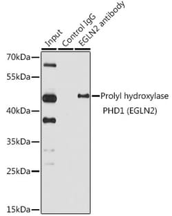 Invitrogen PHD1 Recombinant Rabbit Monoclonal Antibody (3G4) 100 &mu;L;