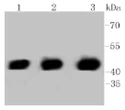 Invitrogen PHD1 Recombinant Rabbit Monoclonal Antibody (3G4) 100 &mu;L;