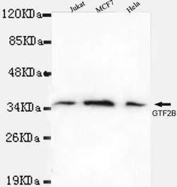 Invitrogen GTF2B Monoclonal Antibody (3H2) 100 &mu;L | Buy Online | Invitrogen&trade; | Fisher Scientific
