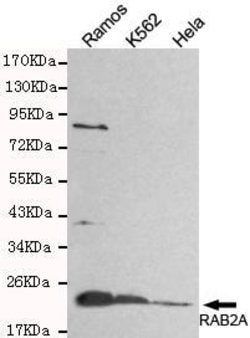 Invitrogen RAB2A Monoclonal Antibody (4C5) 100 &mu;L; Unconjugated:Antibodies,