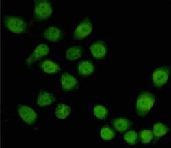 Invitrogen TBL1X Monoclonal Antibody (4H2) 100 &mu;L; Unconjugated:Antibodies,
