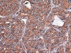 Invitrogen Carboxypeptidase A1 Monoclonal Antibody (OTI2A3) 100 &mu;L;