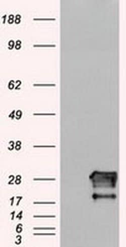 Invitrogen Neurogenin 1 Monoclonal Antibody (OTI9A8) 100 &mu;L; Unconjugated:Antibodies,