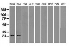 Invitrogen Neurogenin 1 Monoclonal Antibody (OTI9A8) 100 &mu;L; Unconjugated:Antibodies,