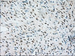 Invitrogen TRPM4 Monoclonal Antibody (OTI10H5) 100 &mu;L | Buy Online | Invitrogen&trade; | Fisher Scientific