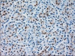 Invitrogen TRPM4 Monoclonal Antibody (OTI10H5) 100 &mu;L | Buy Online | Invitrogen&trade; | Fisher Scientific