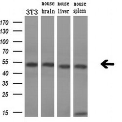 Invitrogen SSB Monoclonal Antibody (OTI1E11) 100 &mu;L; Unconjugated:Antibodies,