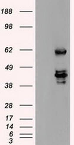Invitrogen SSB Monoclonal Antibody (OTI1E11) 100 &mu;L; Unconjugated:Antibodies,