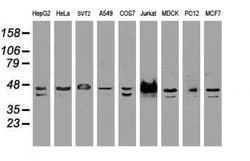 Invitrogen SSB Monoclonal Antibody (OTI1E11) 100 &mu;L; Unconjugated:Antibodies,