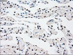 Invitrogen SSB Monoclonal Antibody (OTI9D6) 100 &mu;L; Unconjugated:Anticuerpos