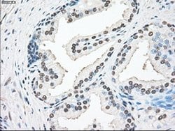 Invitrogen SSB Monoclonal Antibody (OTI9D6) 100 &mu;L; Unconjugated:Anticuerpos