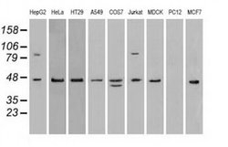 Invitrogen SSB Monoclonal Antibody (OTI9D6) 100 &mu;L; Unconjugated:Anticuerpos