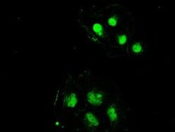 Invitrogen SSB Monoclonal Antibody (OTI2C8) 100 &mu;L; Unconjugated:Antibodies,
