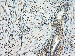 Invitrogen SSB Monoclonal Antibody (OTI2C8) 100 &mu;L; Unconjugated:Antibodies,