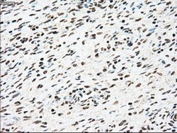Invitrogen SSB Monoclonal Antibody (OTI2C8) 100 &mu;L; Unconjugated:Antibodies,