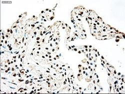 Invitrogen SSB Monoclonal Antibody (OTI2C8) 100 &mu;L; Unconjugated:Antibodies,