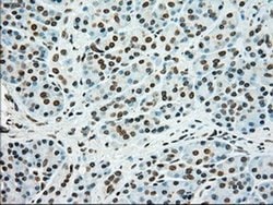 Invitrogen SSB Monoclonal Antibody (OTI2C8) 100 &mu;L; Unconjugated:Antibodies,