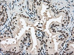 Invitrogen SSB Monoclonal Antibody (OTI2C8) 100 &mu;L; Unconjugated:Antibodies,