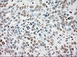 Invitrogen SSB Monoclonal Antibody (OTI2C8) 100 &mu;L; Unconjugated:Antibodies,