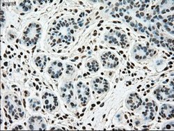 Invitrogen SSB Monoclonal Antibody (OTI2C8) 100 &mu;L; Unconjugated:Antibodies,
