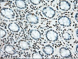 Invitrogen SSB Monoclonal Antibody (OTI2C8) 100 &mu;L; Unconjugated:Antibodies,