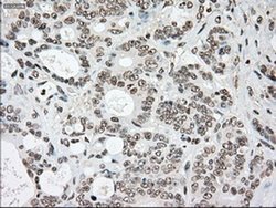 Invitrogen SSB Monoclonal Antibody (OTI2C8) 100 &mu;L; Unconjugated:Antibodies,
