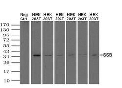Invitrogen SSB Monoclonal Antibody (OTI2C8) 100 &mu;L; Unconjugated:Antibodies,