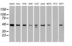 Invitrogen SSB Monoclonal Antibody (OTI2C8) 100 &mu;L; Unconjugated:Antibodies,