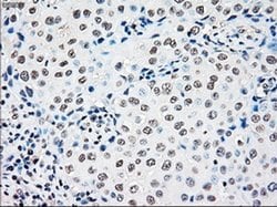 Invitrogen RAD9 Monoclonal Antibody (OTI7B11) 100 &mu;L; Unconjugated:Antibodies,