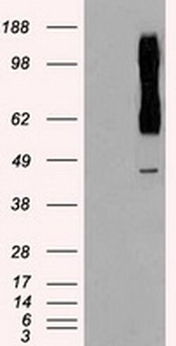 Invitrogen RAD9 Monoclonal Antibody (OTI7B11) 100 &mu;L; Unconjugated:Antibodies,