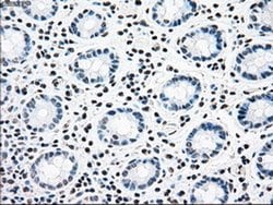 Invitrogen CNDP1 Monoclonal Antibody (OTI2F8) 100 &mu;L; Unconjugated:Antibodies,
