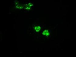 Invitrogen GCK Monoclonal Antibody (OTI3E3) 100 &mu;L; Unconjugated:Antibodies,