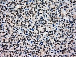 Invitrogen GCK Monoclonal Antibody (OTI3E3) 100 &mu;L; Unconjugated:Antibodies,