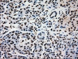 Invitrogen GCK Monoclonal Antibody (OTI3E3) 100 &mu;L; Unconjugated:Antibodies,