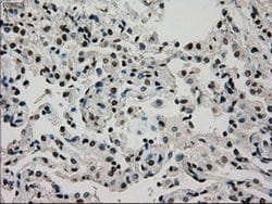 Invitrogen GCK Monoclonal Antibody (OTI3E3) 100 &mu;L; Unconjugated:Antibodies,