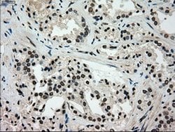 Invitrogen GCK Monoclonal Antibody (OTI3E3) 100 &mu;L; Unconjugated:Antibodies,