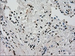 Invitrogen GCK Monoclonal Antibody (OTI3E3) 100 &mu;L; Unconjugated:Antibodies,