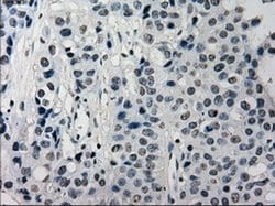 Invitrogen SATB1 Monoclonal Antibody (OTI11H4) 100 &mu;L | Buy Online | Invitrogen&trade; | Fisher Scientific