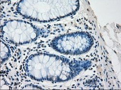 Invitrogen SATB1 Monoclonal Antibody (OTI11H4) 100 &mu;L | Buy Online | Invitrogen&trade; | Fisher Scientific