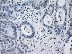 Invitrogen SATB1 Monoclonal Antibody (OTI11H4) 100 &mu;L | Buy Online | Invitrogen&trade; | Fisher Scientific