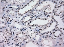 Invitrogen SATB1 Monoclonal Antibody (OTI11H4) 100 &mu;L | Buy Online | Invitrogen&trade; | Fisher Scientific