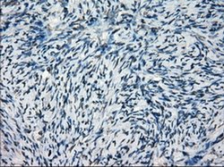 Invitrogen SATB1 Monoclonal Antibody (OTI11H4) 100 &mu;L | Buy Online | Invitrogen&trade; | Fisher Scientific