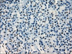 Invitrogen SATB1 Monoclonal Antibody (OTI11H4) 100 &mu;L | Buy Online | Invitrogen&trade; | Fisher Scientific