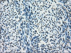 Invitrogen SATB1 Monoclonal Antibody (OTI11H4) 100 &mu;L | Buy Online | Invitrogen&trade; | Fisher Scientific