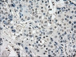 Invitrogen JMJD2C Monoclonal Antibody (OTI5B9) 100 &mu;L; Unconjugated:Antibodies,