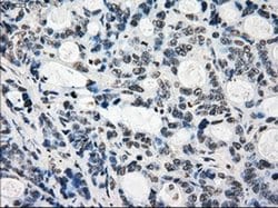 Invitrogen JMJD2C Monoclonal Antibody (OTI5B9) 100 &mu;L; Unconjugated:Antibodies,